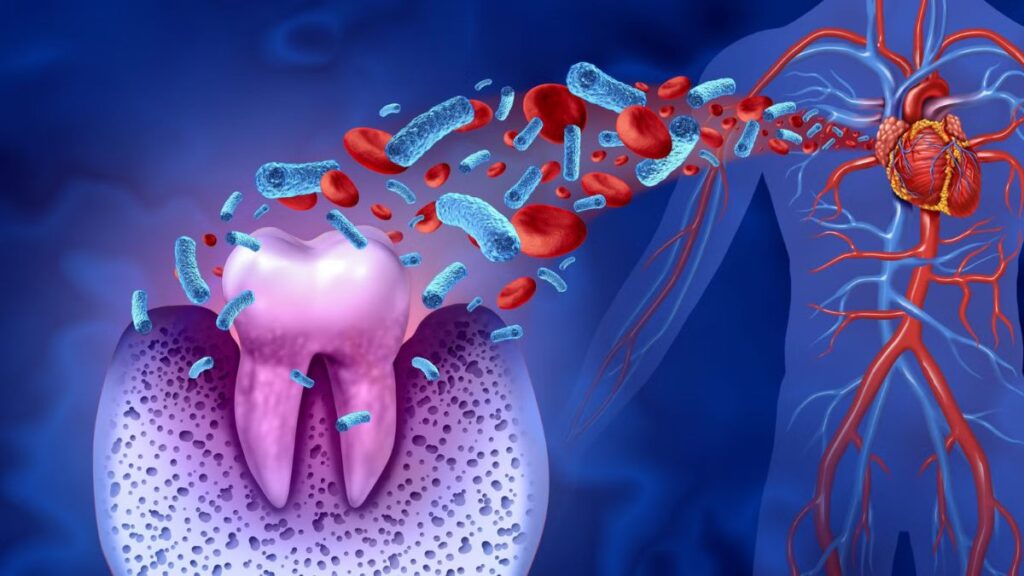 Gum Health