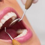The Role Of Preventive Dentistry In Achieving Beautiful, Healthy Smiles